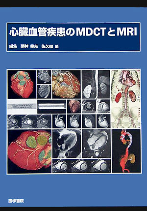 楽天ブックス: 心臓血管疾患のMDCTとMRI - 栗林幸夫 - 9784260000574 : 本