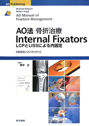 正規店安いAO法骨折治療internal fixators : LCPとLISSによる内… 健康・医学