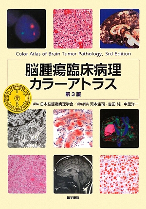 楽天ブックス: 脳腫瘍臨床病理カラーアトラス第3版 - 日本脳腫瘍病理