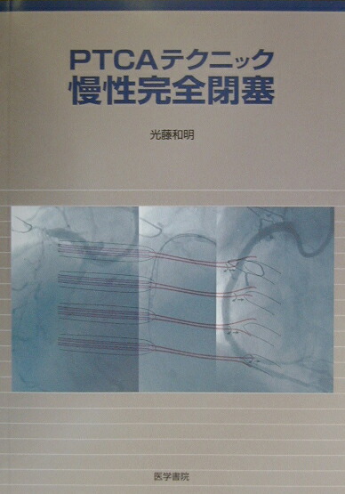 CTO―慢性完全閉塞病変に対するPTCAの適応と戦略 [単行本] 加藤修; 光藤和明 楽天ブックス: PTCAテクニック慢性完全閉塞 - 光藤和明