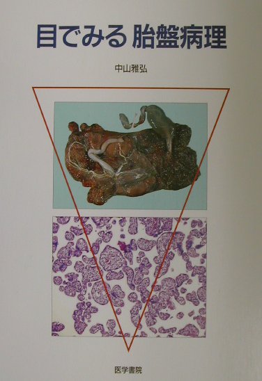 目でみる胎盤病理/医学書院/中山雅弘（大型本） 楽天ブックス: 目でみる胎盤病理 - 中山雅弘 - 9784260130639 : 本