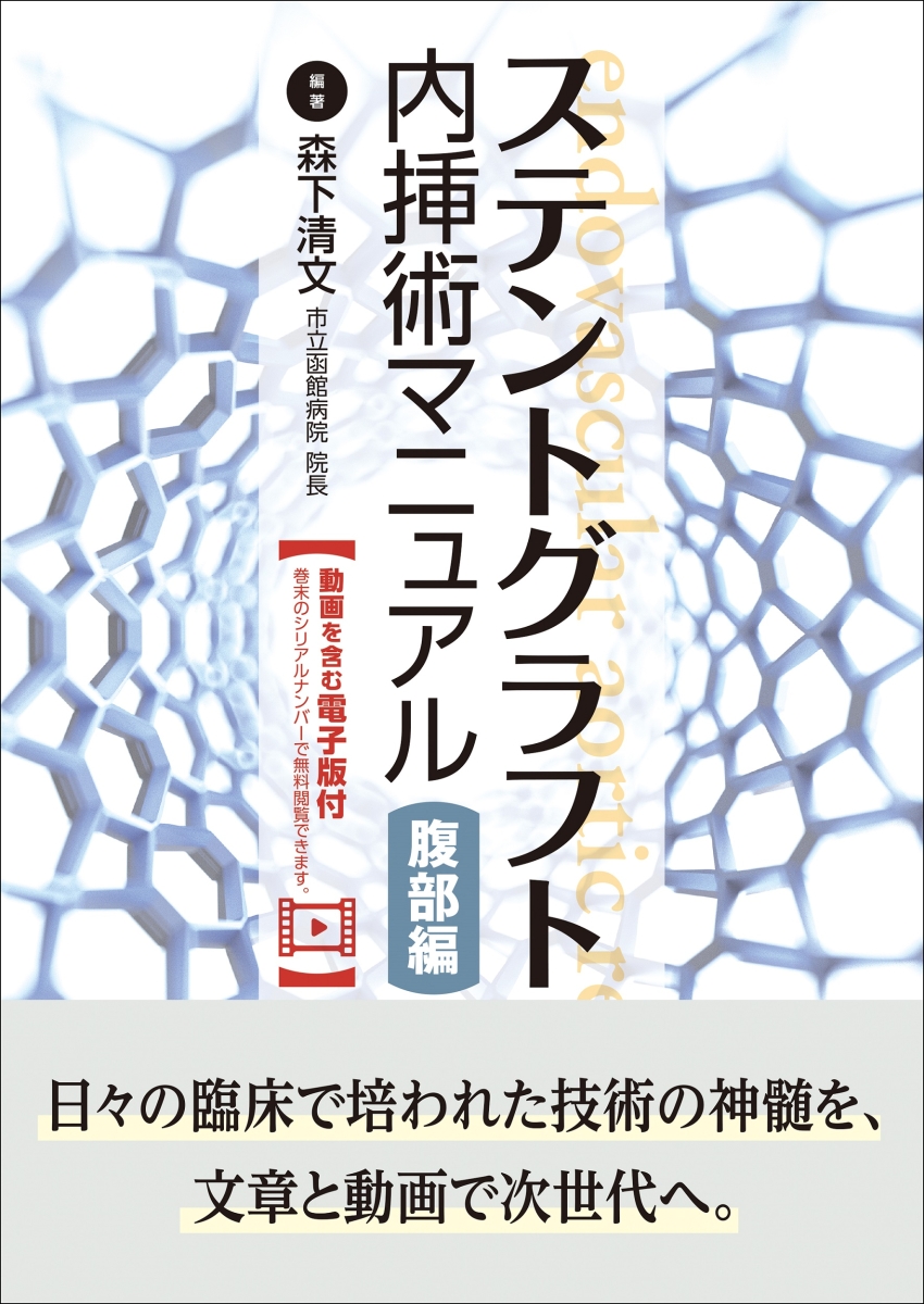 正規店仕入れの ステントグラフト内挿術マニュアル 腹部編 動画を含む電子版付 在庫限り Www Nationalmuseum Gov Ph