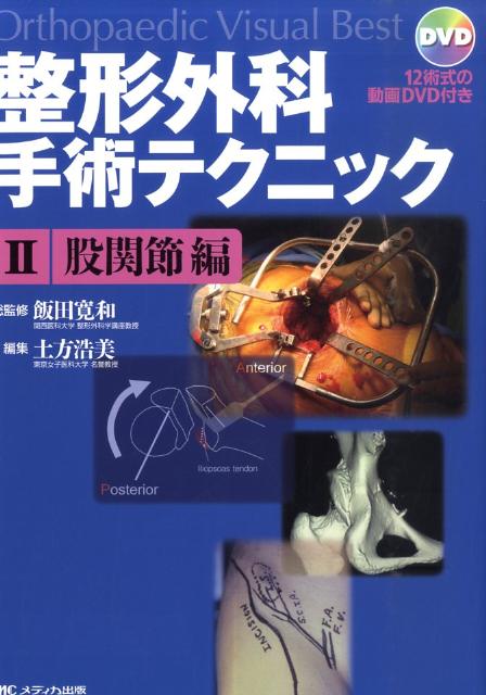 整形外科手術テクニック Ｏｒｔｈｏｐａｅｄｉｃ　ｖｉｓｕａｌ　ｂｅｓｔ １/メディカ出版/飯田寛和（単行本） 整形外科手術テクニック Orthopaedic visual
