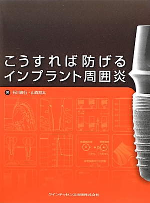 楽天ブックス: こうすれば防げるインプラント周囲炎 - 石川高行 