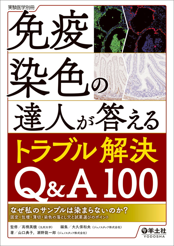 免疫染色の達人が答えるトラブル解決Q&A100（実験医学別冊）[高橋英機]
