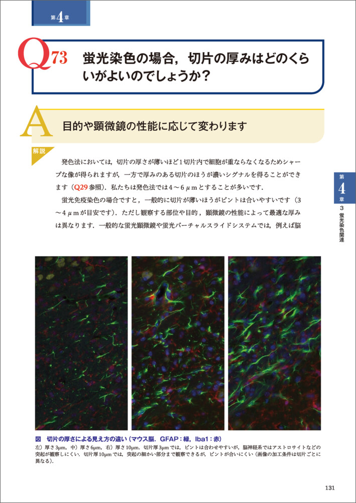 免疫染色の達人が答えるトラブル解決Q&A100（実験医学別冊）[高橋英機]