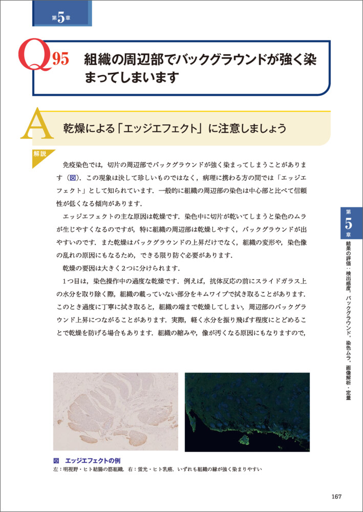 免疫染色の達人が答えるトラブル解決Q&A100（実験医学別冊）[高橋英機]