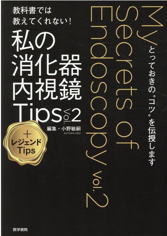 ʽǤ϶ƤʤξòTipsVol.2ܥ쥸TipsȤäƤΡȥġɤޤ[һ]