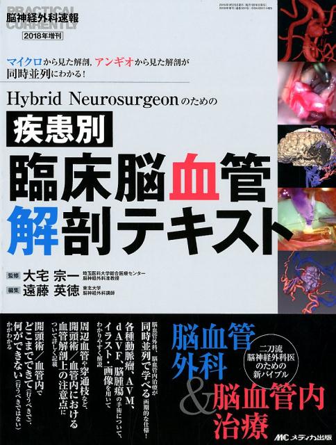 楽天ブックス 疾患別 臨床脳血管解剖テキスト Hybrid Neurosurgeonのための 大宅 宗一 本