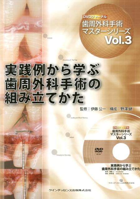 実践例から学ぶ歯周外科手術の組み立てかた　（DVDジャーナル）