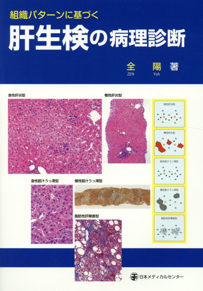 組織パターンに基づく肝生検の病理診断