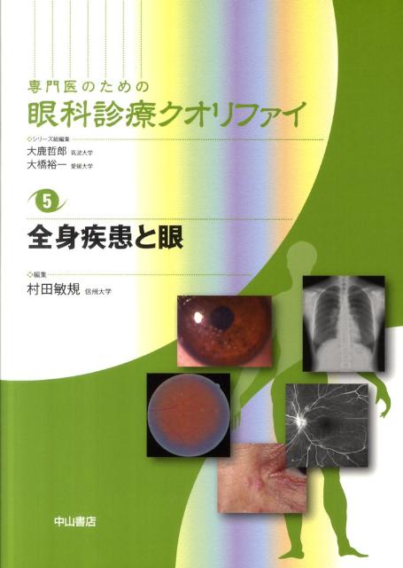 楽天ブックス: 専門医のための眼科診療クオリファイ（5） - 村田敏規