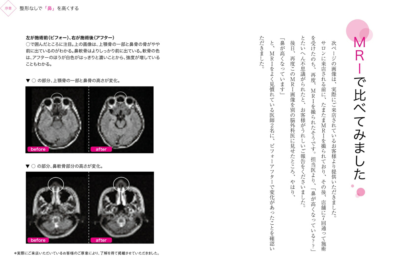 굻ɡ⤯ɡ̿ۡδɡפλܽѤȥե[ŷͳ]