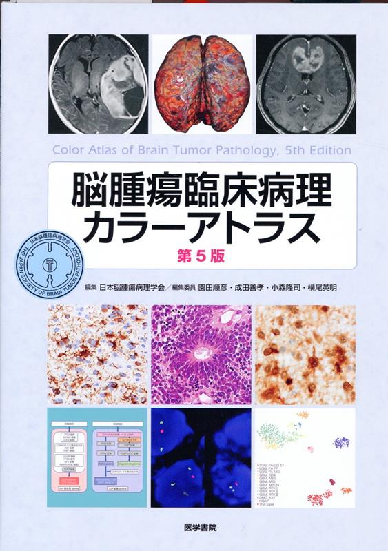 楽天ブックス: 脳腫瘍臨床病理カラーアトラス 第5版 - 日本脳腫瘍病理 
