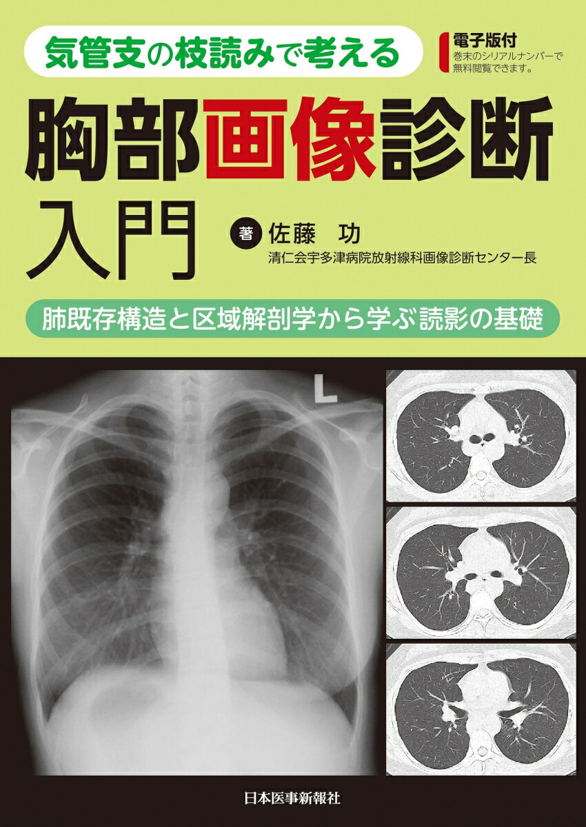 楽天ブックス: 気管支の枝読みで考える 胸部画像診断入門 肺既存構造と