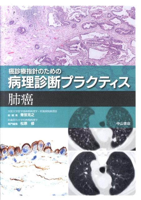 楽天ブックス: 癌診療指針のための病理診断プラクティス 肺癌 - 青笹