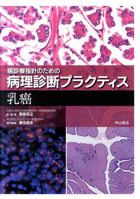 楽天ブックス: 癌診療指針のための病理診断プラクティス 乳癌 - 青笹