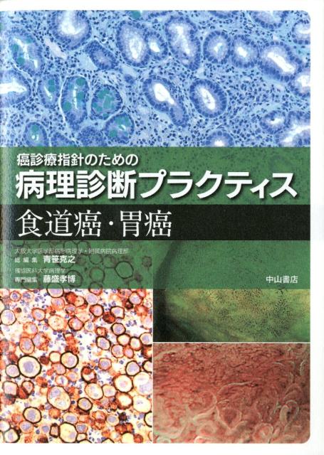 大腸癌 (癌診療指針のための病理診断プラクティス) [単行本] 八尾隆史; 青笹克之 大腸癌 (癌診療指針のための病理診断プラクティス) | 八尾隆史