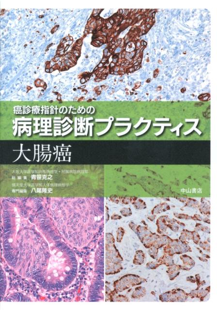 楽天ブックス: 癌診療指針のための病理診断プラクティス 大腸癌 - 青笹