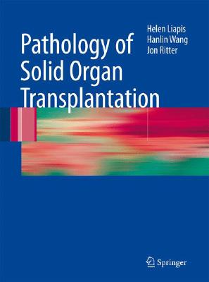 Seal限定商品 Pathology Of Solid Organ Transplantation Pathology Of Solid Organ Trans Web限定 Www Most Gov La Seal限定商品 Pathology Of Solid Organ Transplantation Pathology Of Solid Organ Trans Web限定 Www Most Gov La