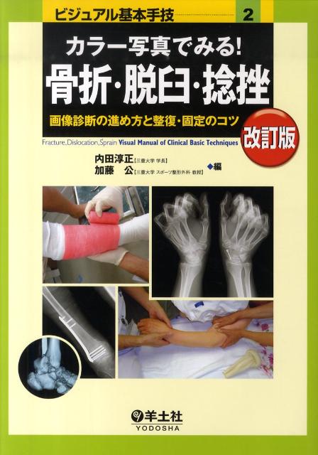 楽天ブックス: カラー写真でみる！骨折・脱臼・捻挫改訂版 - 画像診断 