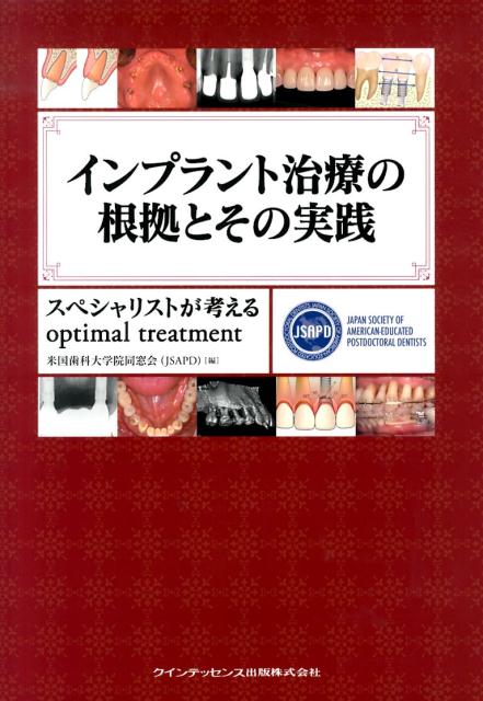 楽天ブックス: インプラント治療の根拠とその実践 - スペシャリストが考えるoptimal treatm - 米国歯科大学院同窓会 -  9784781203560 : 本