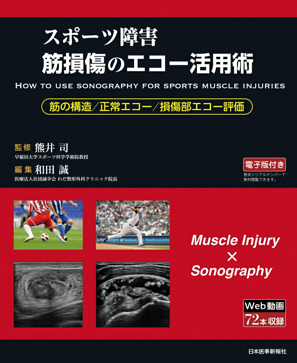 膝エコーのすべて〈解剖・診断・インターベンション〉 膝エコーのすべて〈解剖・診断・インターベンション〉 | 中瀬