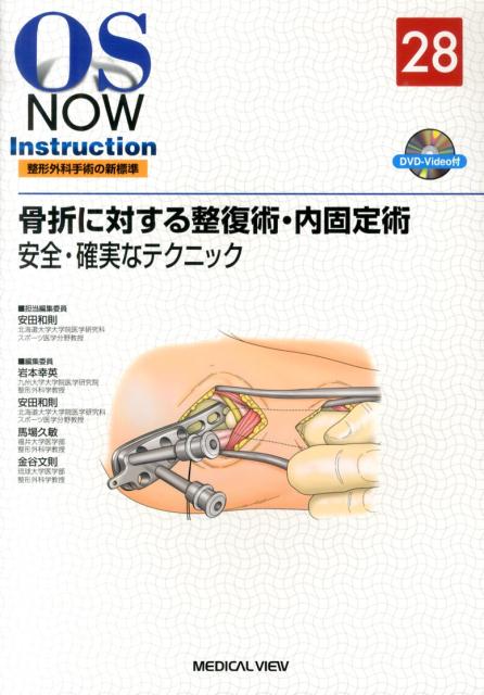 楽天ブックス: 骨折に対する整復術・内固定術 - 安全・確実なテクニック - 安田和則 - 9784758313575 : 本