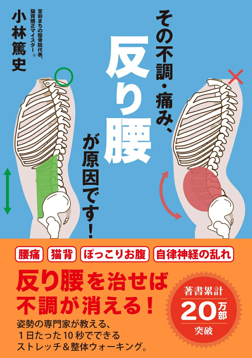 楽天ブックス: その不調・痛み、反り腰が原因です！ - 小林 篤史 - 9784863113695 : 本