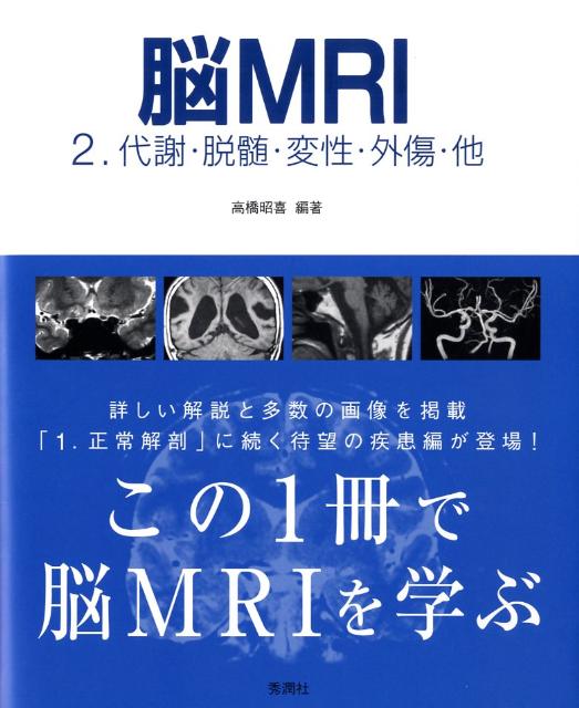 楽天ブックス: 脳MRI（2） - 高橋昭喜 - 9784879623775 : 本