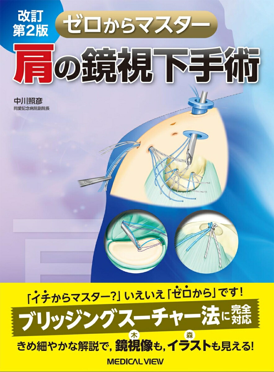 楽天ブックス: ゼロからマスター 肩の鏡視下手術 - 中川 照彦 - 9784758313797 : 本