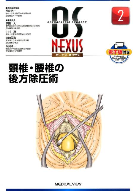 楽天ブックス: 頸椎・腰椎の後方除圧術 - 西良浩一 - 9784758313810 : 本