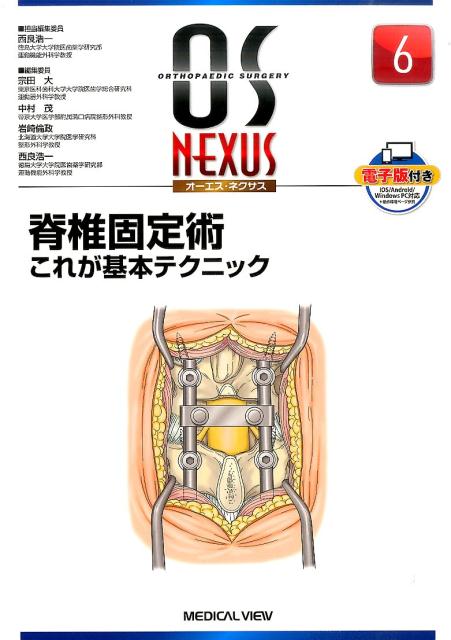 楽天ブックス: 脊椎固定術これが基本テクニック - 西良浩一