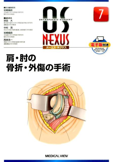 肩・肘の骨折・外傷の手術 （OS　NEXUS）