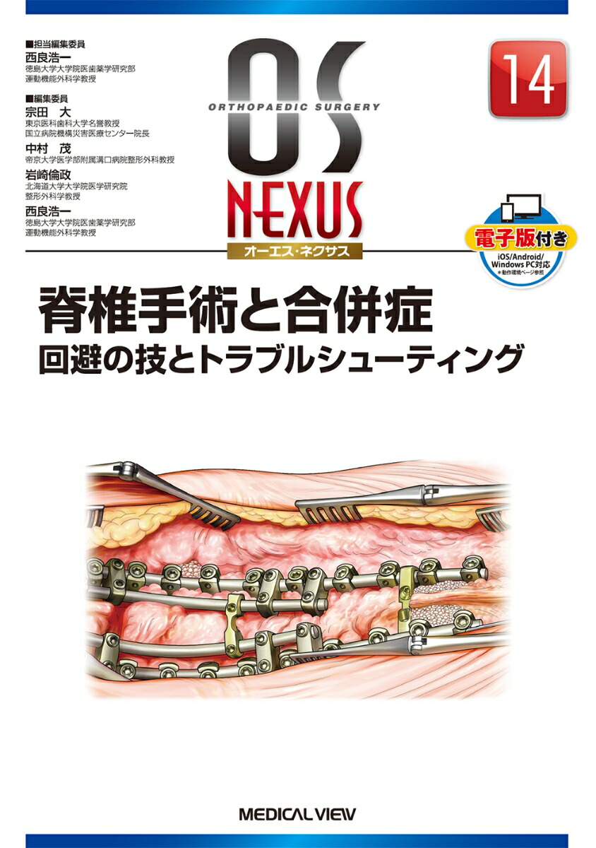 脊椎手術と合併症 回避の技とトラブルシューティング 西良浩一/担当