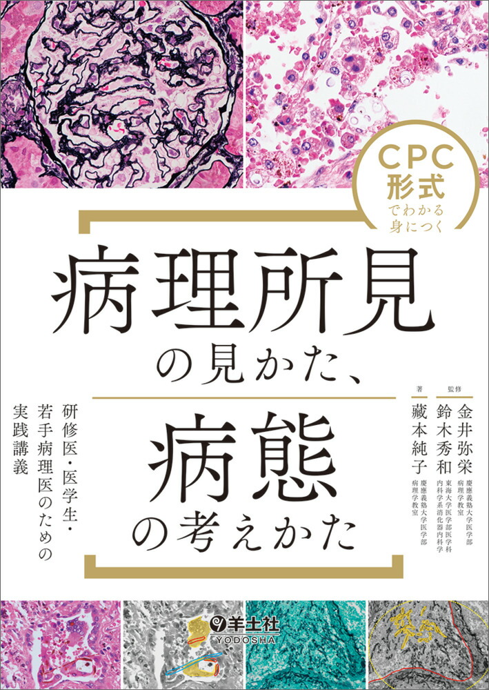 CPCǤ狼ȤˤĤ긫θ֤ιͤ[]