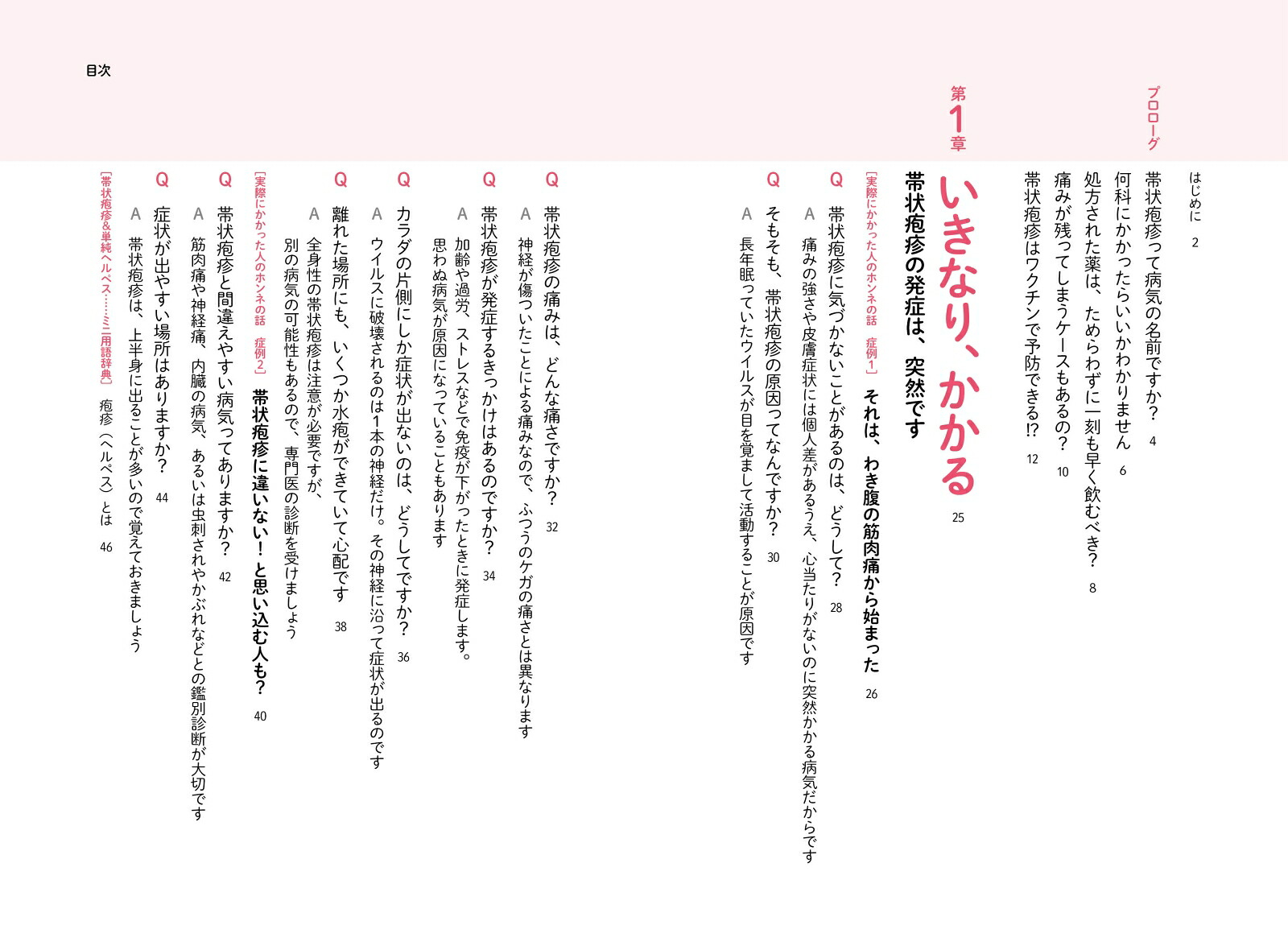 しっかりわかる帯状疱疹最適な治療と痛み対策[漆畑修]