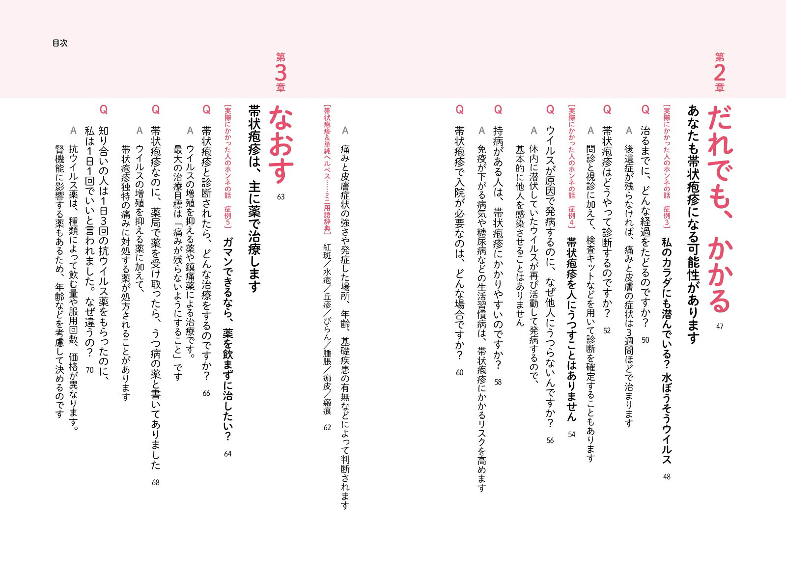 しっかりわかる帯状疱疹最適な治療と痛み対策[漆畑修]
