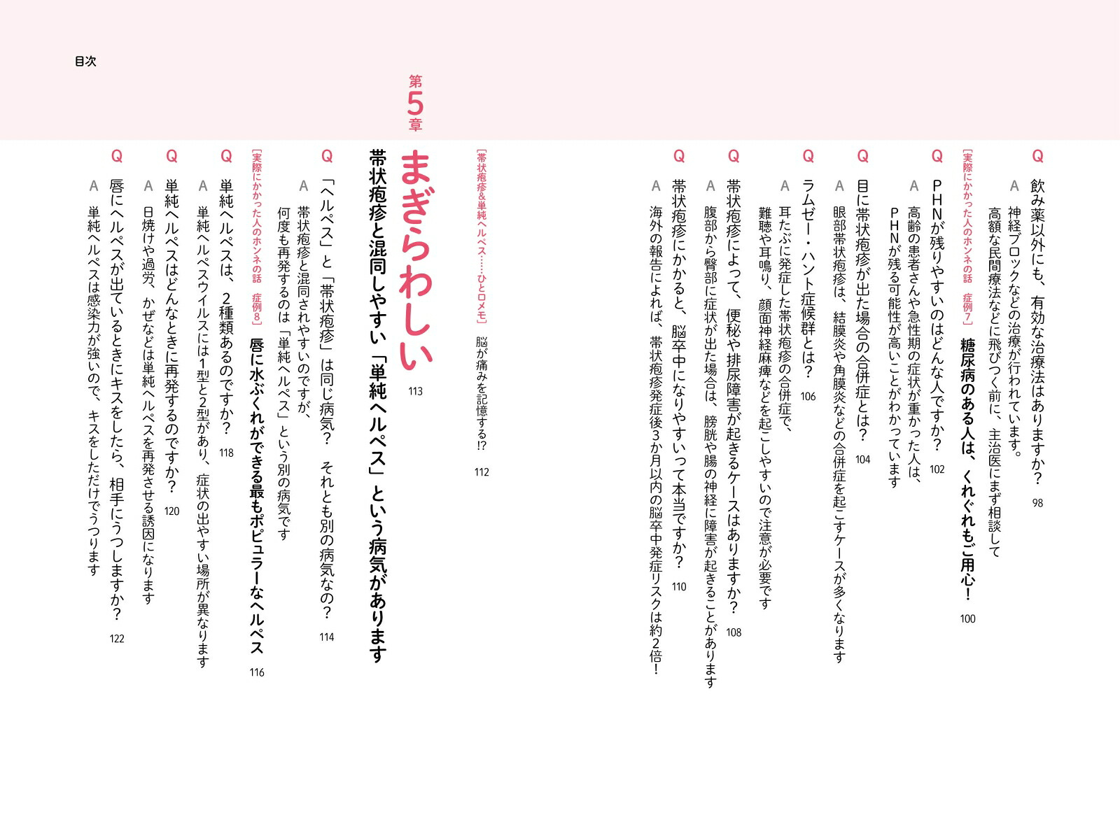 しっかりわかる帯状疱疹最適な治療と痛み対策[漆畑修]