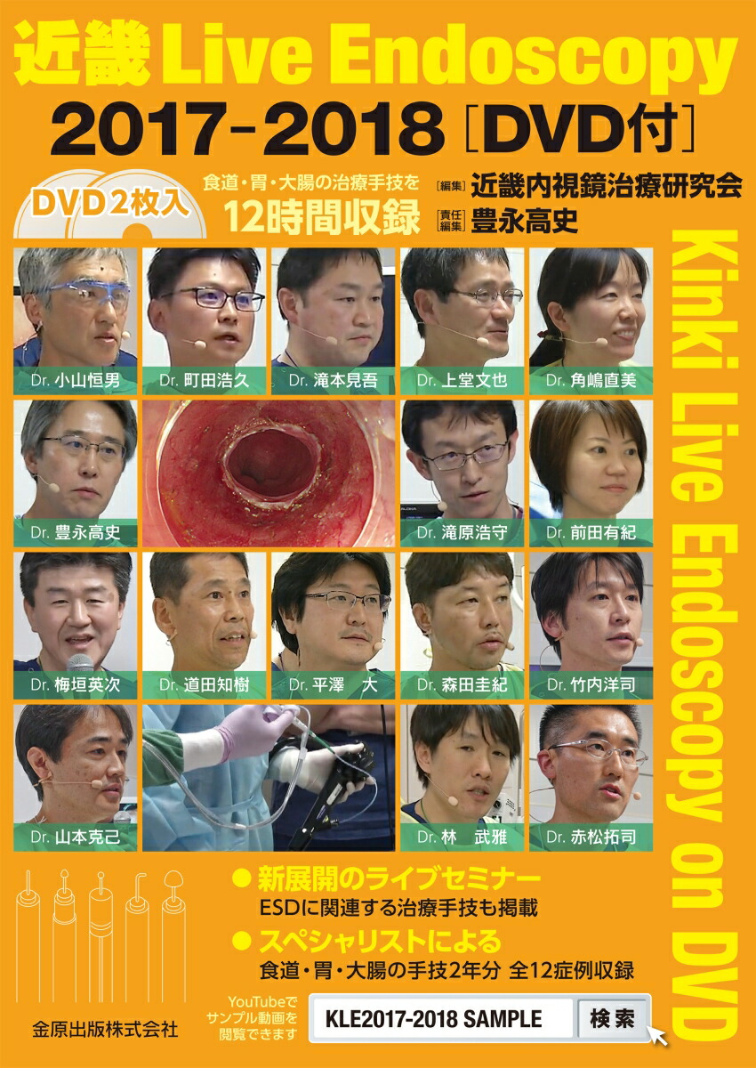 楽天ブックス: 近畿 Live Endoscopy 2017-2018［DVD付］ - 近畿内視鏡