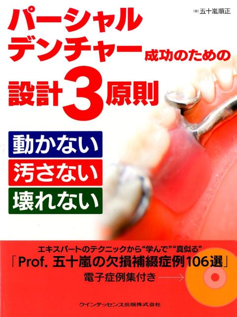 楽天ブックス: パーシャルデンチャー成功のための設計3原則動かない