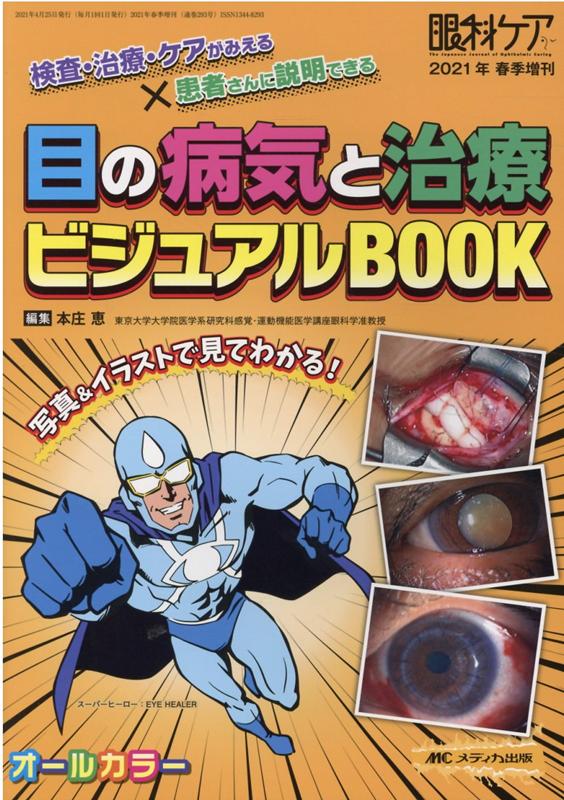 楽天ブックス: 目の病気と治療 ビジュアルBOOK - 検査・治療・ケアが