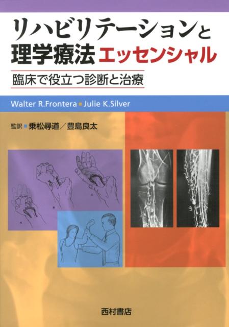 [裁断済]リハビリテーションと理学療法エッセンシャル : 臨床で役立つ診断と治療 楽天ブックス: リハビリテーションと理学療法エッセンシャル - 臨床で
