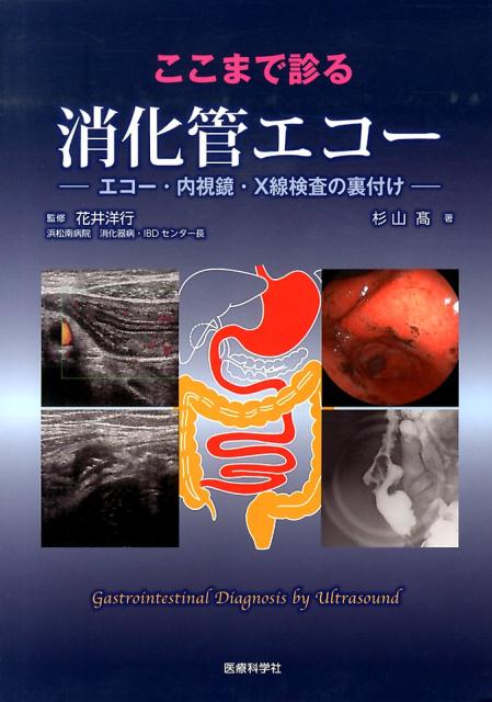 ここまで診る消化管エコー　エコー・内視鏡・X線検査の裏付け