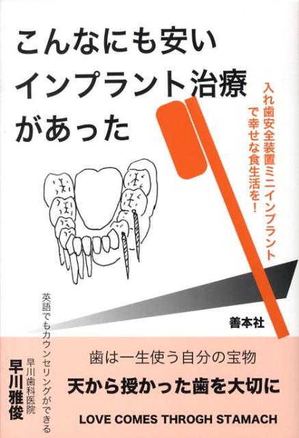 【中古】 こんなにも安いインプラント治療があった 一泊二日で入れ歯に固定するミニインプラント！/善本社/早川雅俊 楽天ブックス: こんなにも安いインプラント治療があった - 一泊