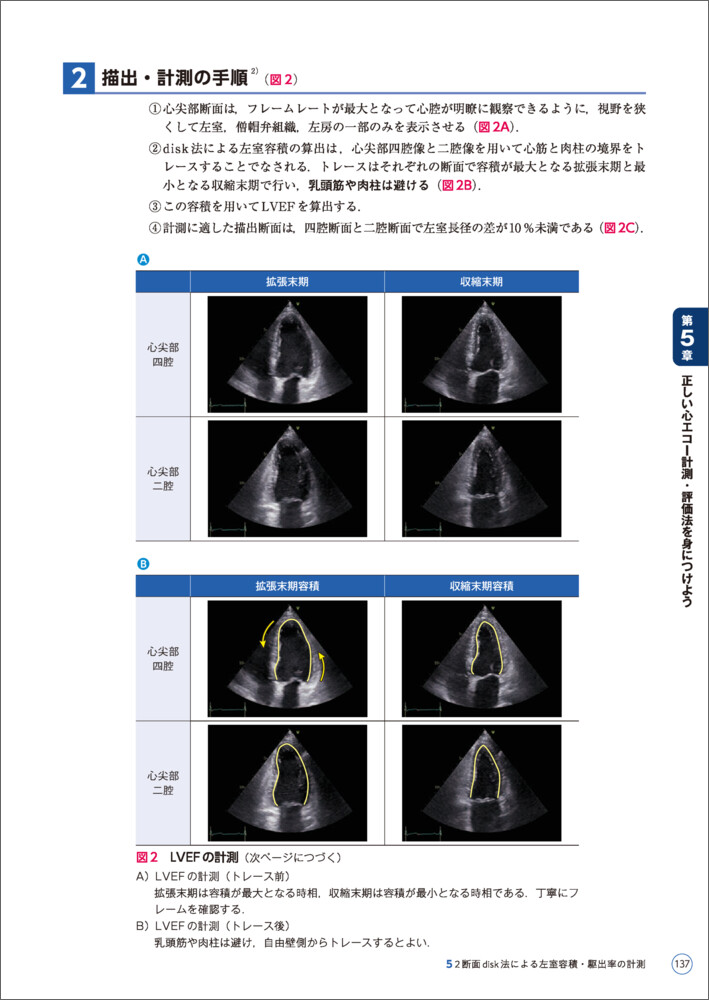 3DCTで解剖から学ぶ心エコーの基本とコツ[大門雅夫]