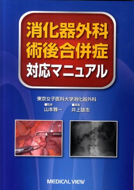 消化器外科周術期合併症のｍｉｎｉｍａｌ　ｒｅｑｕｉｒｅｍｅｎｔｓ 重症度の階層化 消化器外科周術期合併症のminimal requirements 重症度の階層化