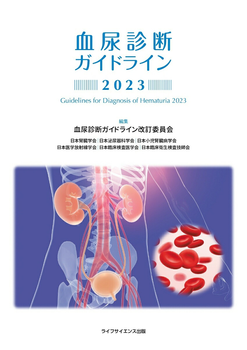 楽天ブックス: 血尿診断ガイドライン2023 - 血尿診断ガイドライン改訂