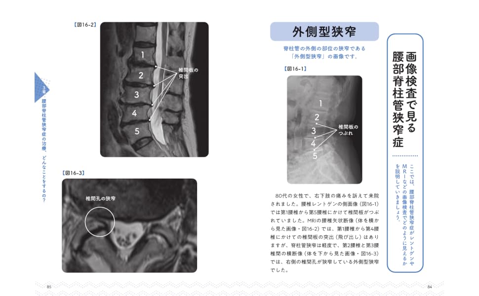 悩み・不安・困った！を専門医がスッキリ解決腰部脊柱管狭窄症[銅冶英雄]