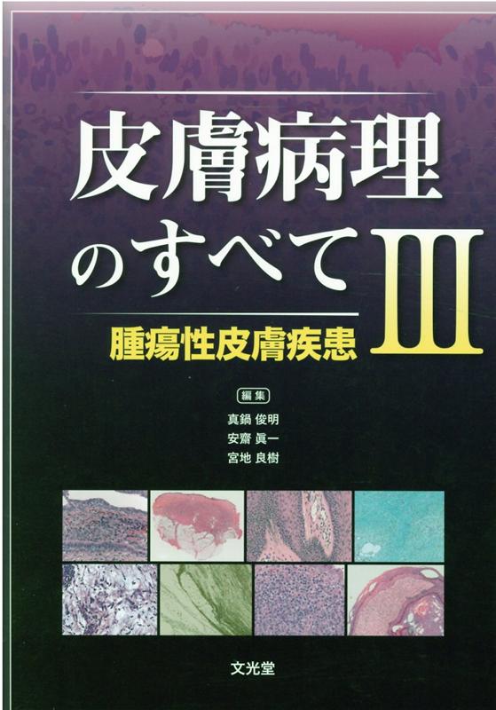 皮膚病理のすべて（3）　腫瘍性皮膚疾患